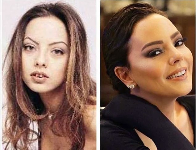 Gel Dese Aşk’ın Bahar’ı İlayda Çevik estetiksiz haliyle olay oldu