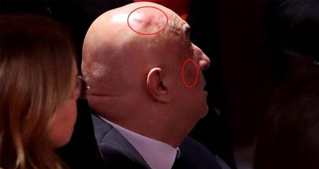 Meclis'teki kavga sonrası kafasında ve yüzünde şişlik oluştu !