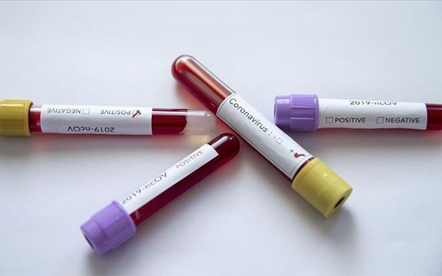 Dünya genelinde koronavirüsten ölenlerin sayısı 40 bini aştı