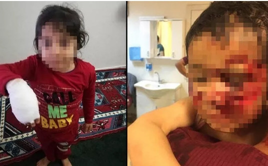 Dehşet! Sokak köpekleri 6 çocuğu parçaladı!