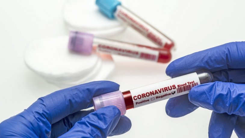 Hangi özel sağlık sigortalar koronavirüs tedavisini kapsıyor?