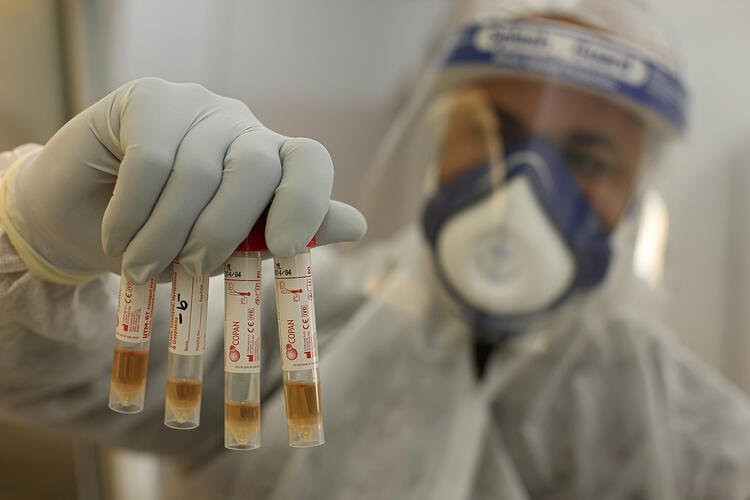 Koronavirüse karşı Video Temas Sistemi geliyor