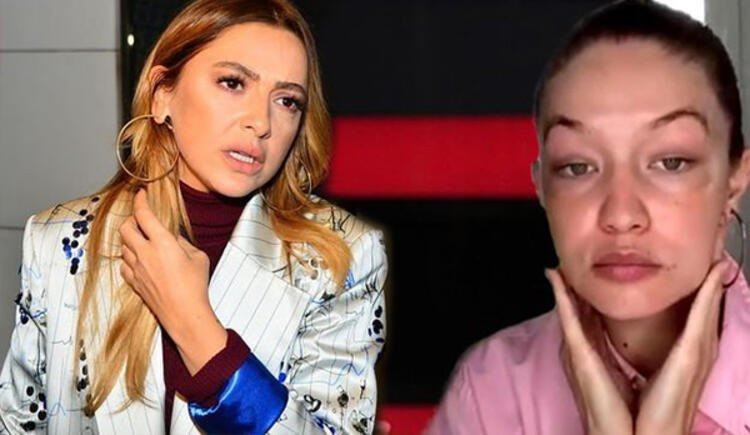 Gigi Hadid'in yüzü için yapılan eleştirilere Hadise'den sert tepki!