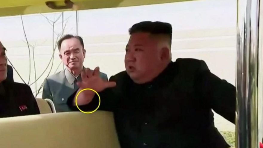 Kim Jong-un’un fotoğrafındaki ''tedavi'' detayı