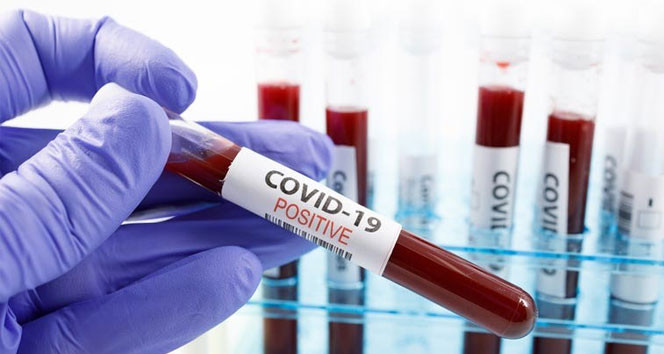 İngiltere'den koronavirüse karşı 5 ilaç birden!