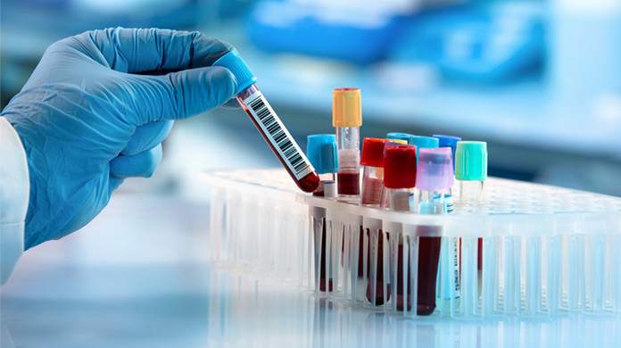 Bir firma daha koronavirüs aşılarının testlerine başlıyor