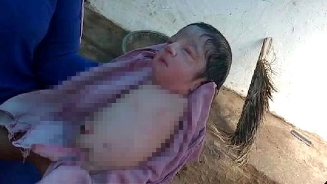 100 binde bir görülüyor! Kolsuz ve bacaksız doğdu