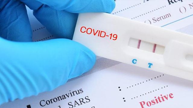 Yurtdışına çıkana ücretli koronavirüs testi! Parası IBAN'a yatacak