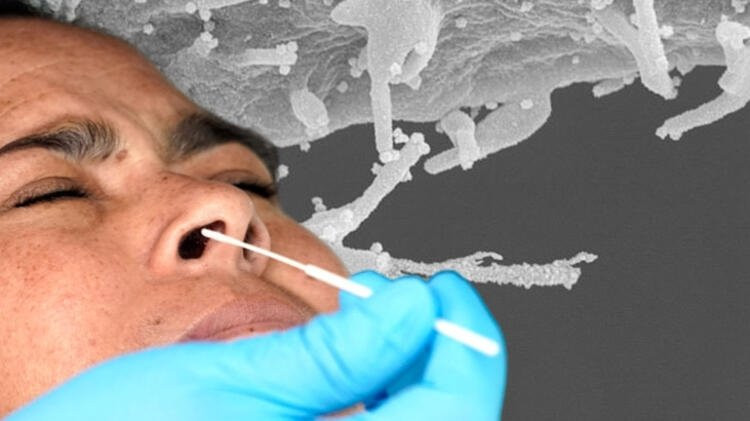 Koronavirüsün yeni fotoğrafı: Zombi gibi yayılıyor!