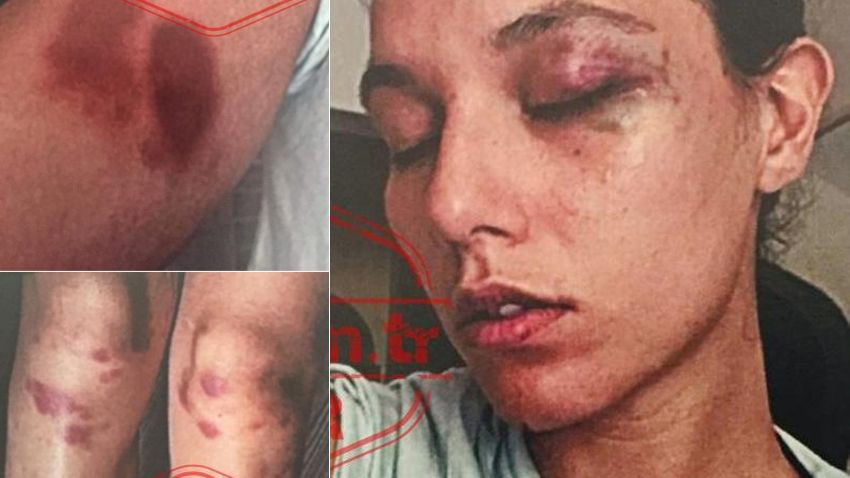 Deniz Bulutsuz’un yeni darp fotoğrafları ortaya çıktı