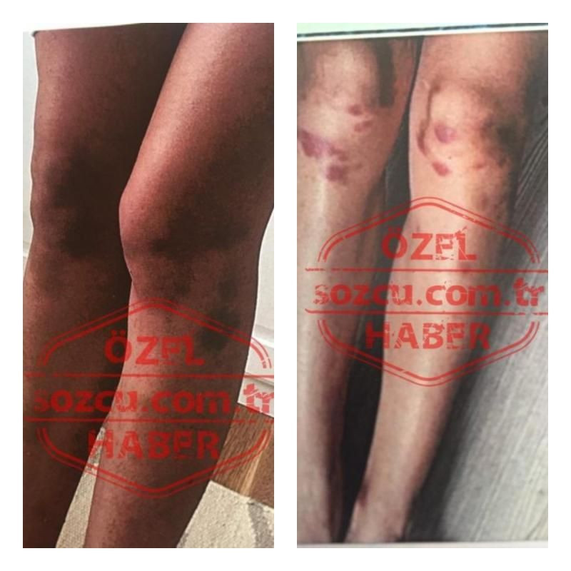 Deniz Bulutsuz’un yeni darp fotoğrafları ortaya çıktı