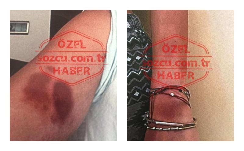 Deniz Bulutsuz’un yeni darp fotoğrafları ortaya çıktı
