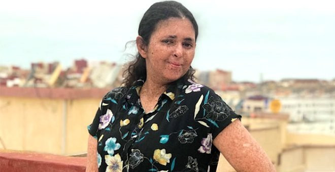 Hastalığı yüzünden 20 yıldır gün ışığına çıkamıyor!