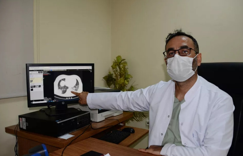 Ablasının tomografisini gösterip uyardı