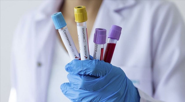 Türk Tabipleri Birliği'nden ''Temaslılara test yapılsın'' çağrısı