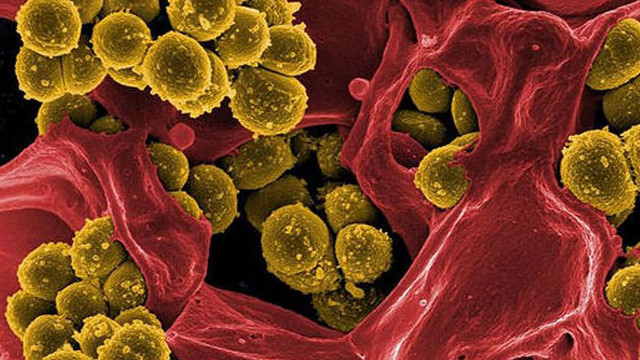 Şoke eden araştırma: Bakterilerin ölüm çığlığı!