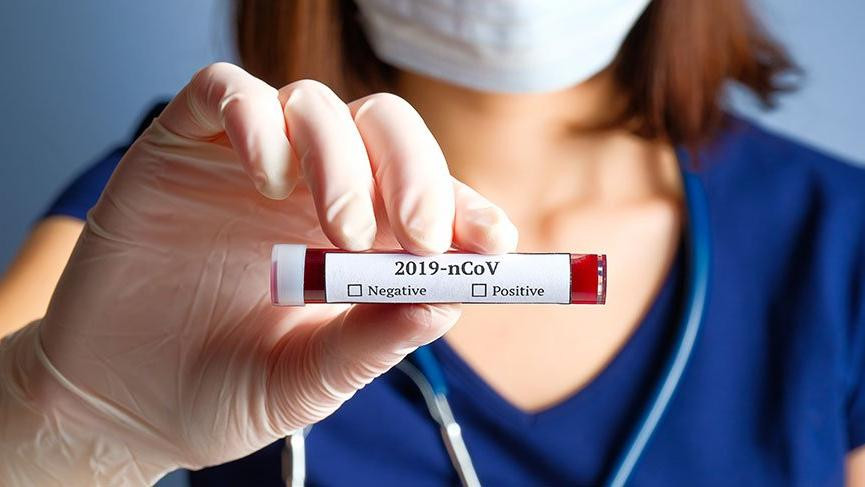 Özel hastanelerde koronavirüs skandalı! Test sonuçları sisteme girilmemiş
