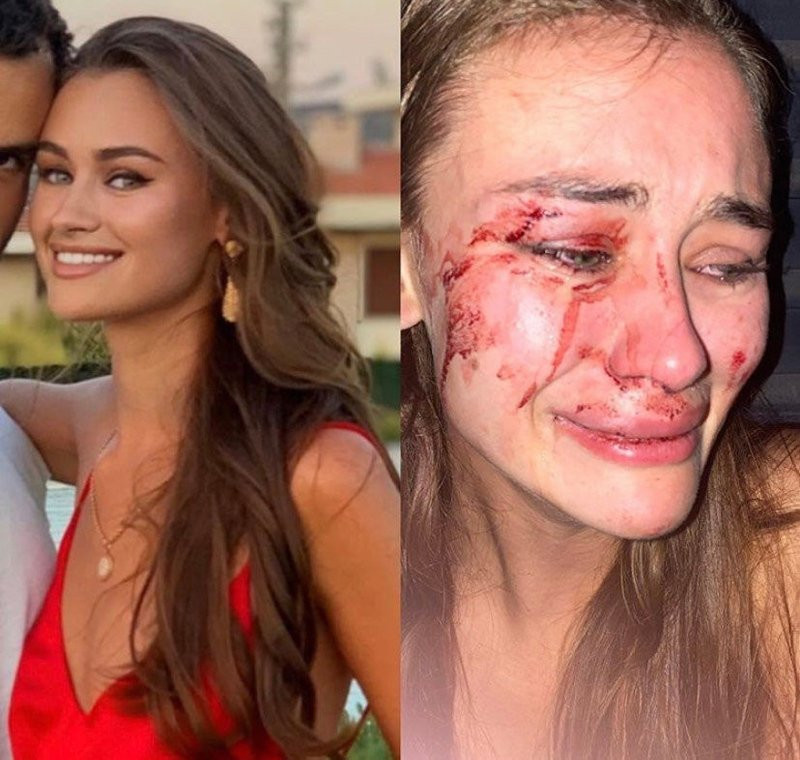 Daria Kyryliuk'tan şoke eden açıklama!
