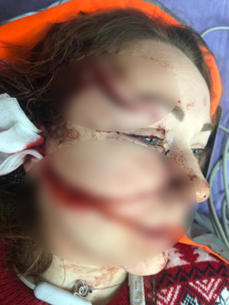 Boşanmak isteyen eşini falçatayla bu hale getirdi! - Resim: 4