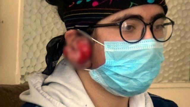 7 yaşındayken taktığı küpeler hayatını kabusa çevirdi