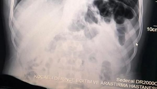 İranlı yolcuların midesinden 871 gram metamfetamin çıktı - Resim: 3