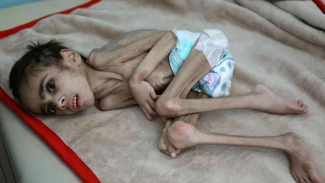 Yürek yakan görüntü! Açlıktan 7 kiloya düştü