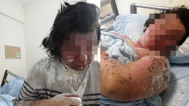 Yanlış ilaç yüzünden hayatı karardı! Çilem'in yardım çığlığı