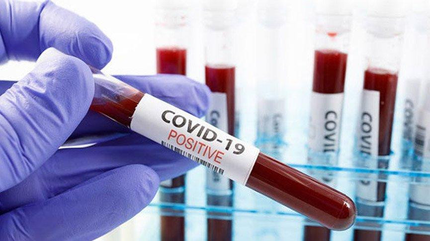 Dünyada bir ilk! 90 kişi kendi isteğiyle Covid-19 olacak