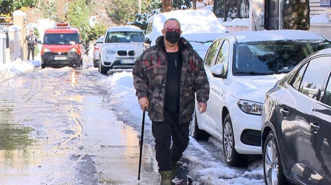 Cem Yılmaz'dan bastonlu önlem