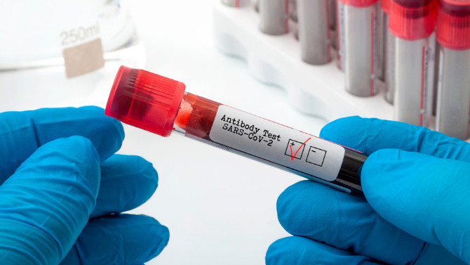 Korona aşısı sonrası antikor testi yapılmalı mı?