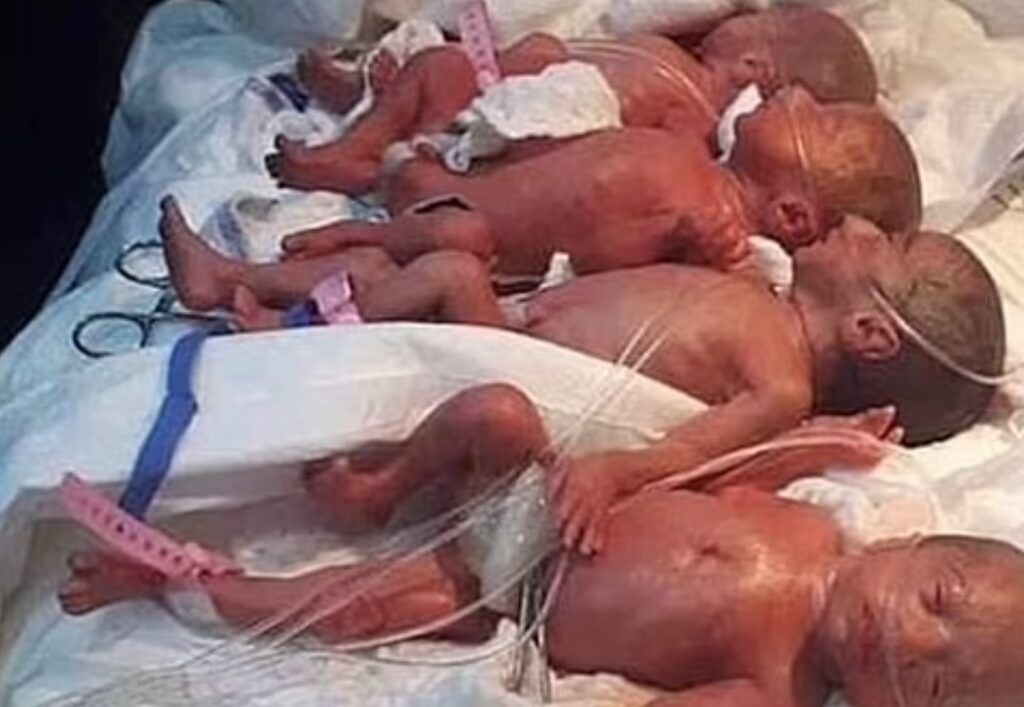 Doktorlar şoke oldu! 7 çocuk bekleyen anne 9 çocuk doğurdu! - Resim: 1