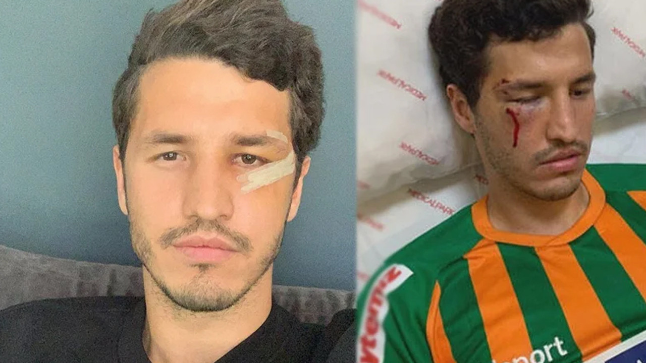 Elmacık kemiği kırılan Salih Uçan'ın dikişleri alındı