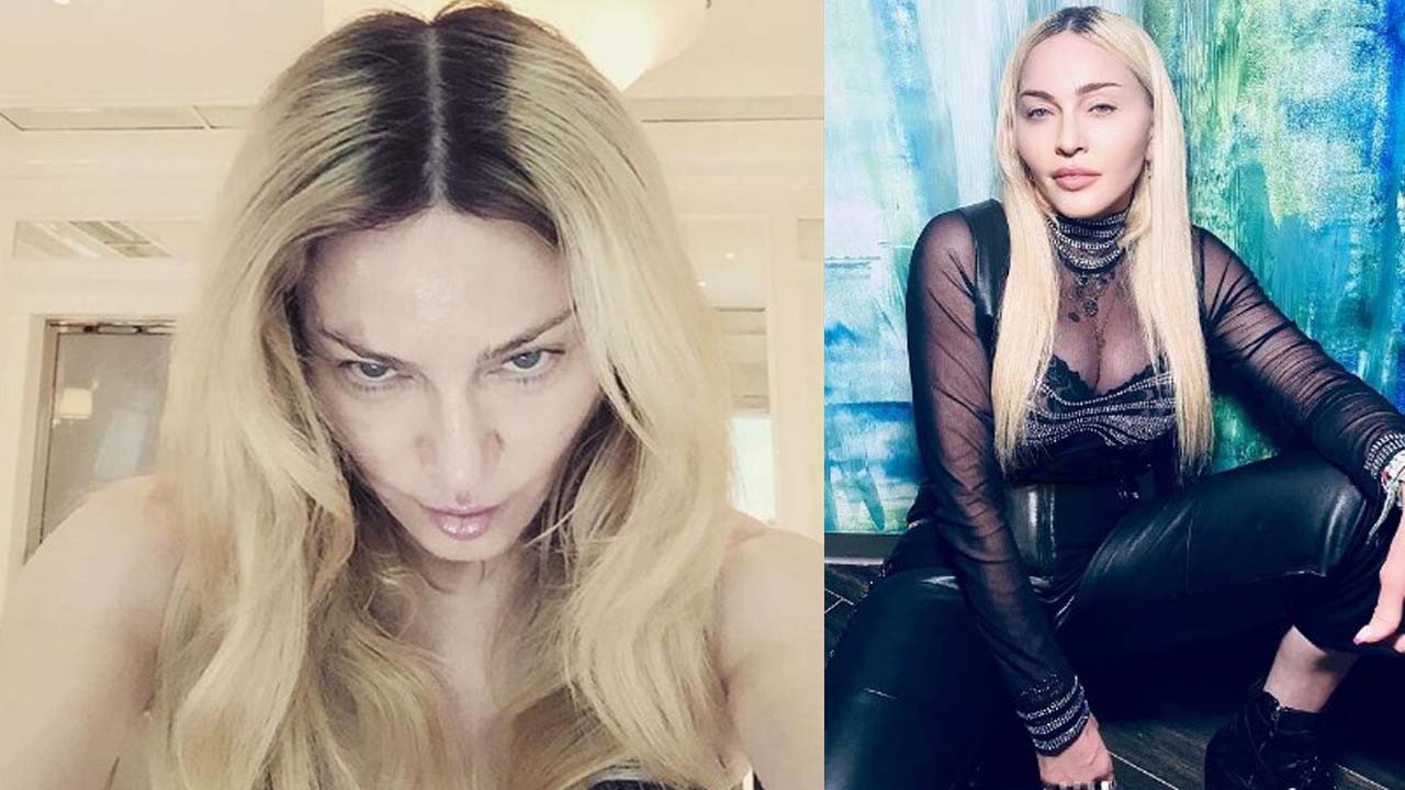 Madonna'nın paylaşımı olay oldu: Filtre mi iğne mi?