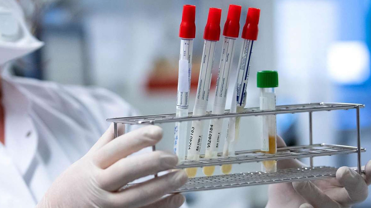 Korona virüs, HIV hastasında 32 kez mutasyona uğradı