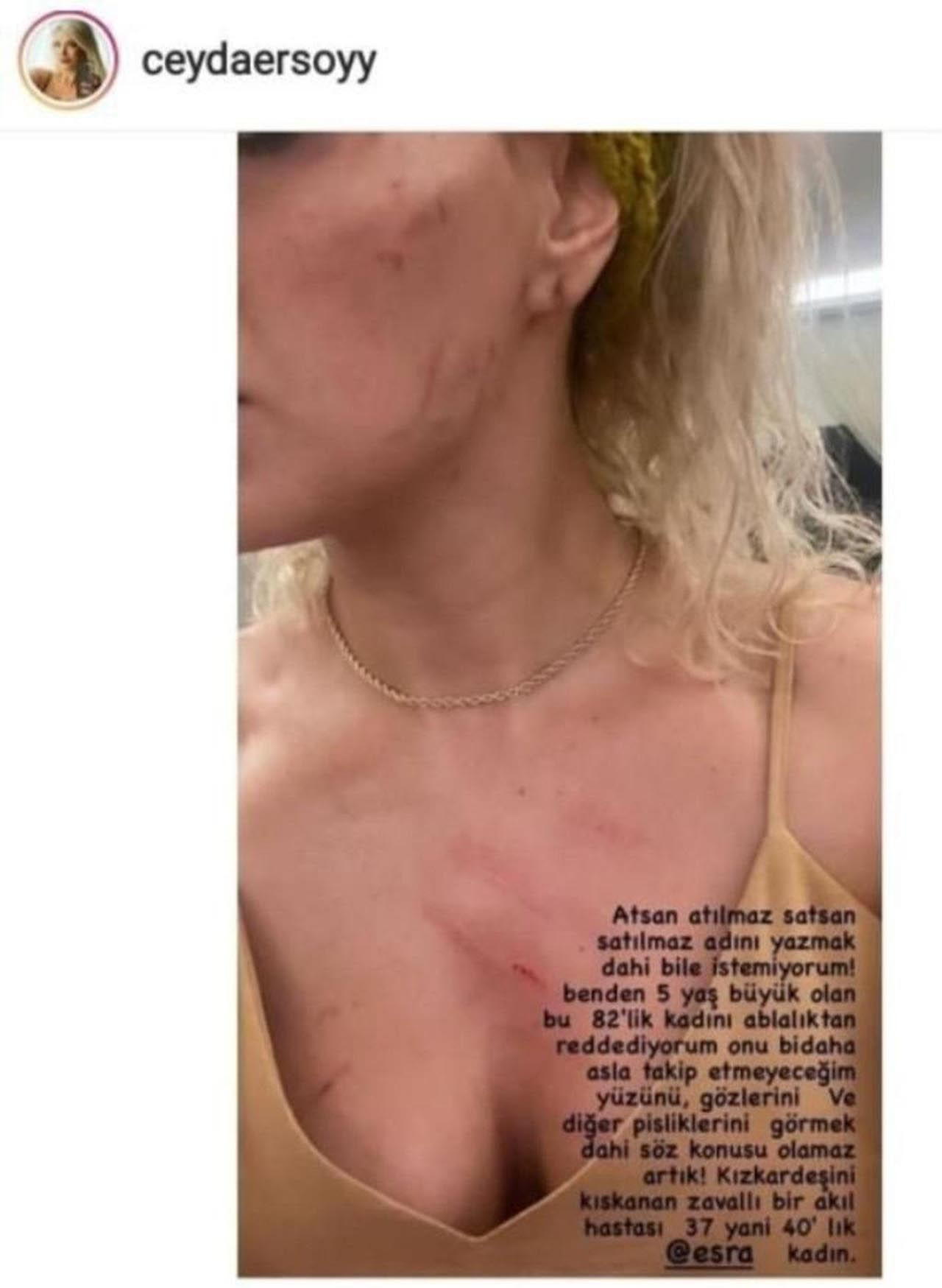 ''Ciciş Ceyda'' bu fotoğrafla duyurdu: ''Ablam beni dövdü'' - Resim: 2