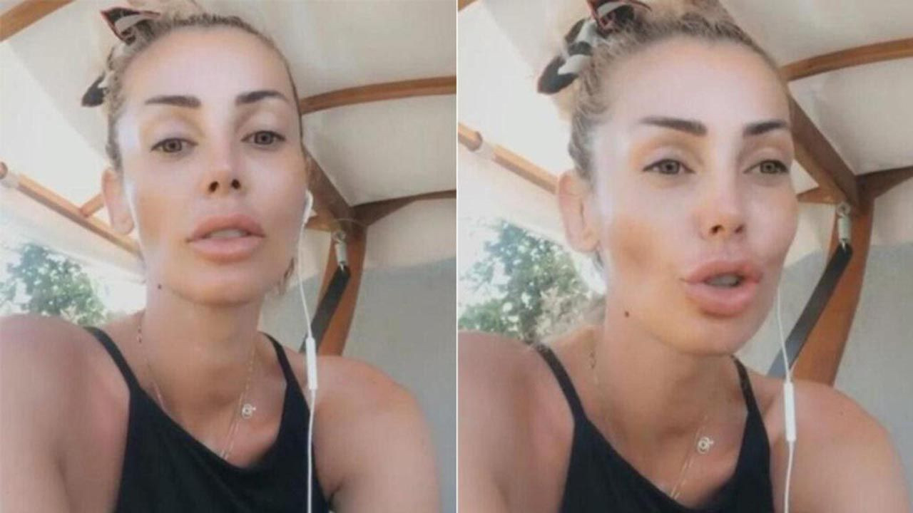 Petek Dinçöz, estetikten tanınmaz hale geldi Haber3
