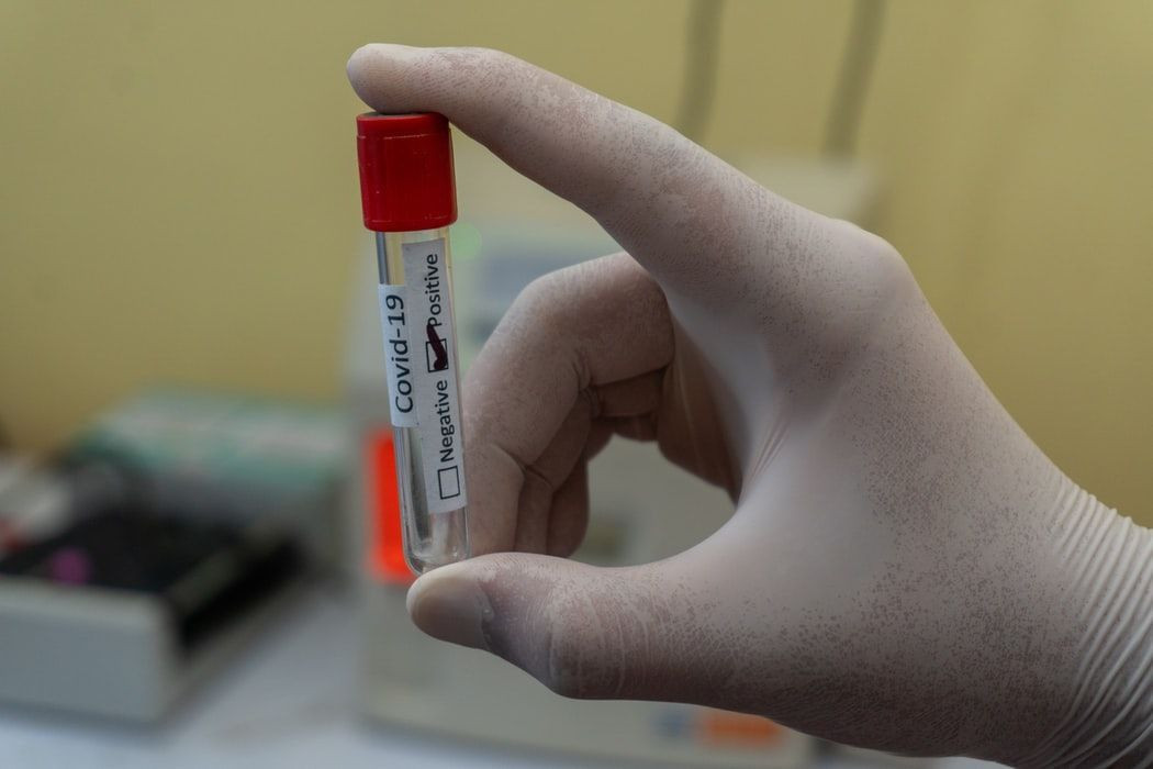 Şimdi aşı olmayan düşünsün: 6 Eylül'de yeni dönem başlıyor - Resim: 4
