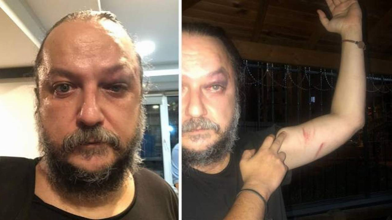 Sanatçı Güvenç Dağüstün’e saldırı