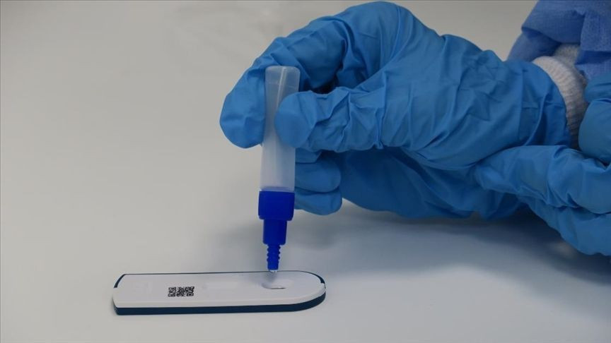 Artık zorunlu! Peki işveren PCR testi yaptırmak istemeyen işçiyi işten çıkartabilecek mi? - Resim: 3