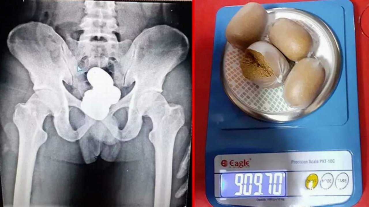Havalimanında şoke eden olay! ''Şeyinden'' 1 kilo altın çıktı!