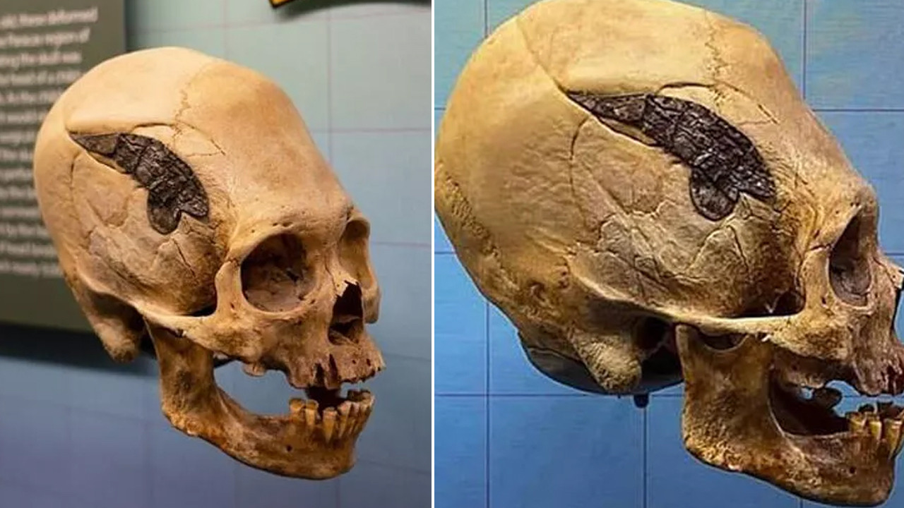 Şaşırtan keşif! Dünyanın en eski kafatası ameliyatı böyle yapılmış!