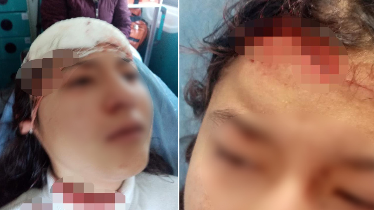 Sokak köpekleri selfie çeken çocuğu parçaladı!