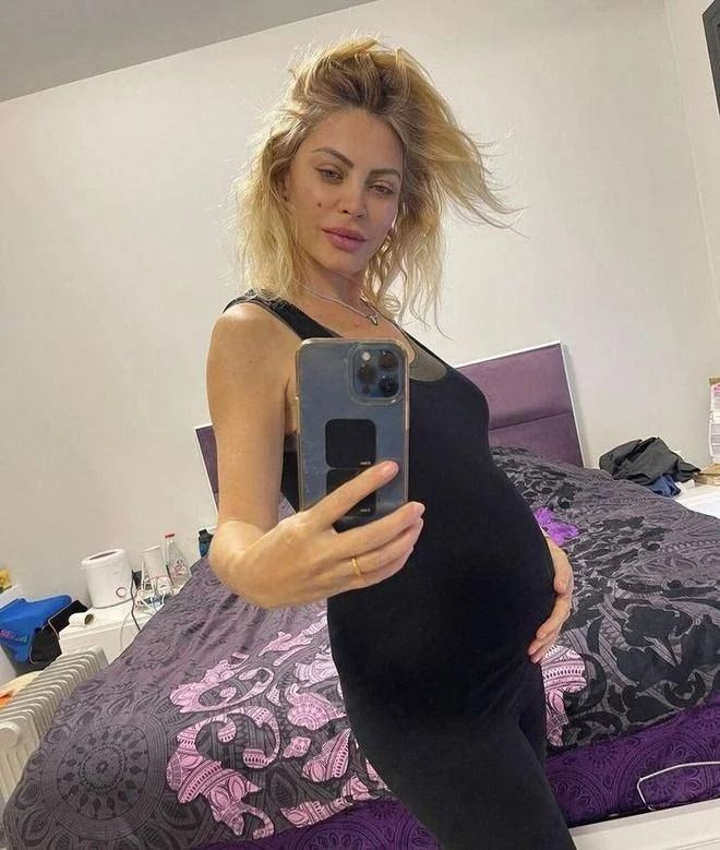 Seray Sever ikiz bebeklerinin ultrason görüntüsünü paylaştı - Resim: 4