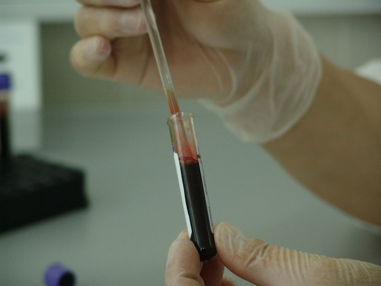 AIDS için mRNA umudu: Testler başladı - Resim: 1