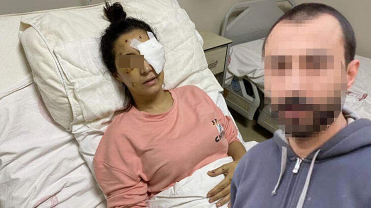 Yengesini 37 yerinden bıçakladı! Talihsiz kadın oğlunun ''idamını'' istiyor