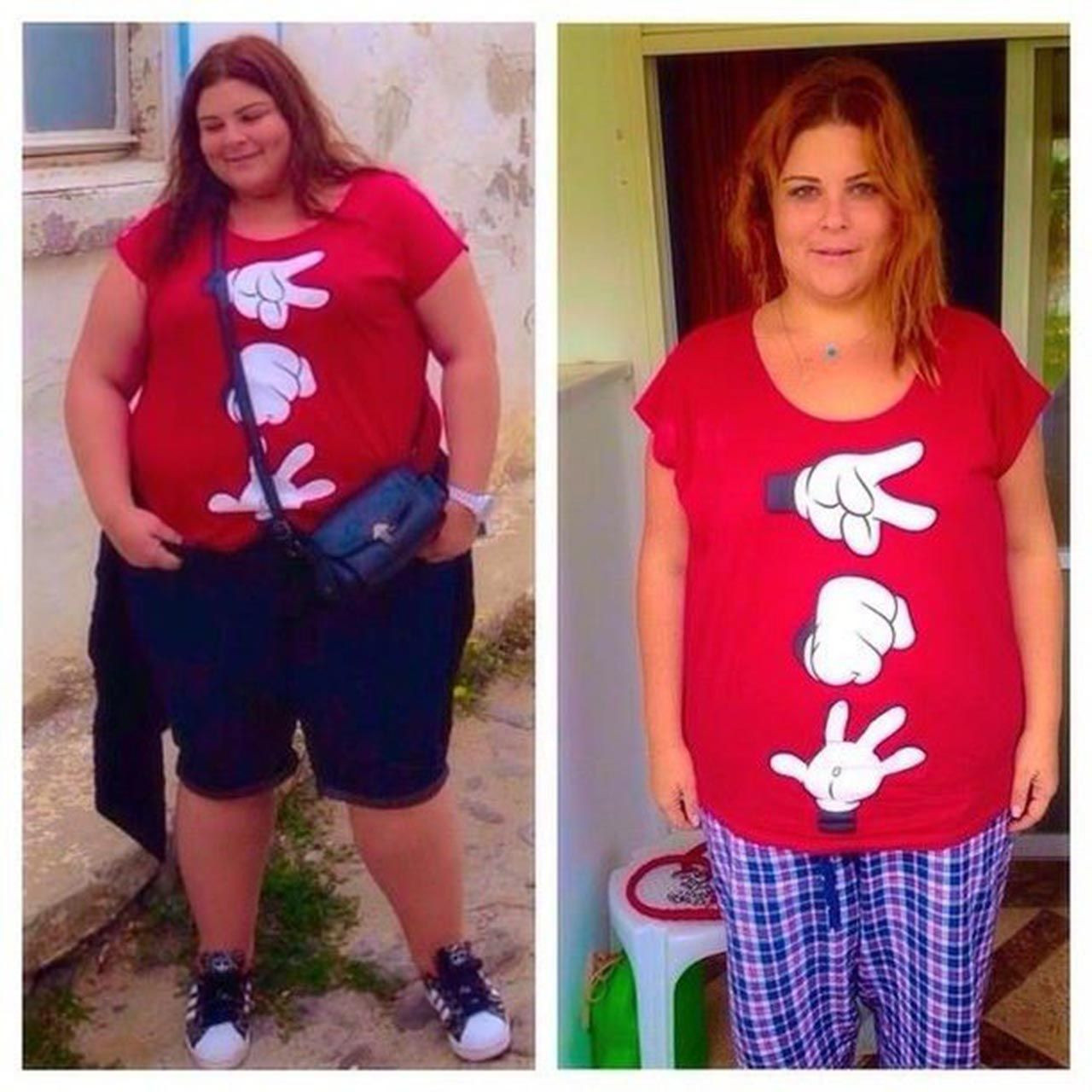 Tam 93 kilo veren güzel oyuncunun bikinili yaz gelsin pozu olay oldu - Resim: 3