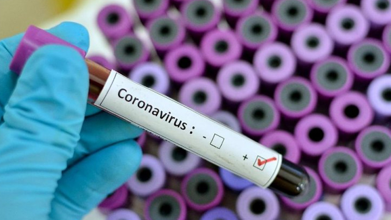 Dikkat: Koronavirüsün bir yan etkisi daha ortaya çıktı