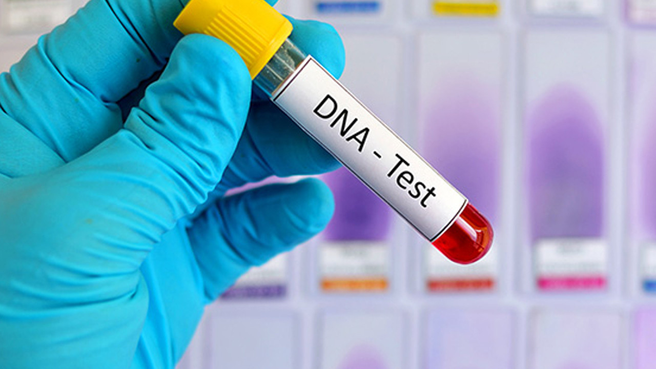 Şaşkına çeviren DNA testi sonucu: Kızının amcası çıktı!