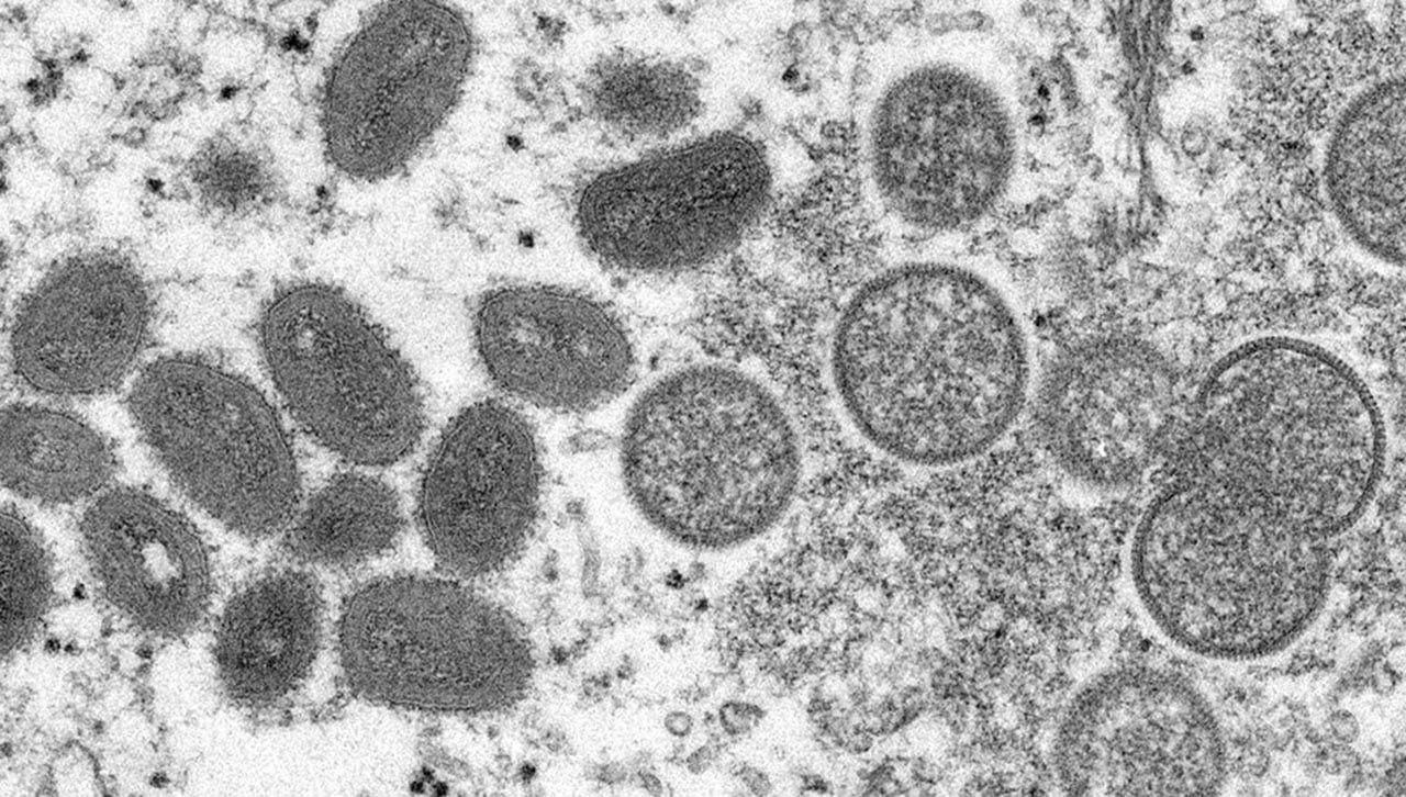 Koronavirüs bitmeden yeni salgın başladı: Maymun çiçeği virüsü yayılıyor! - Resim: 2