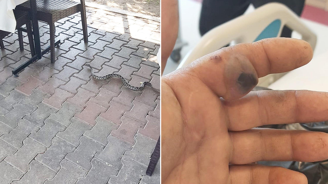 Zehirli yılanın soktuğu adam, yılanla birlikte hastaneye koştu